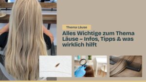 Läuse was kann ich tun