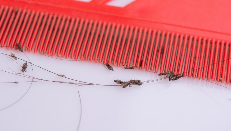 Läuse und Nissen im Haar bei Kindern erkennen
